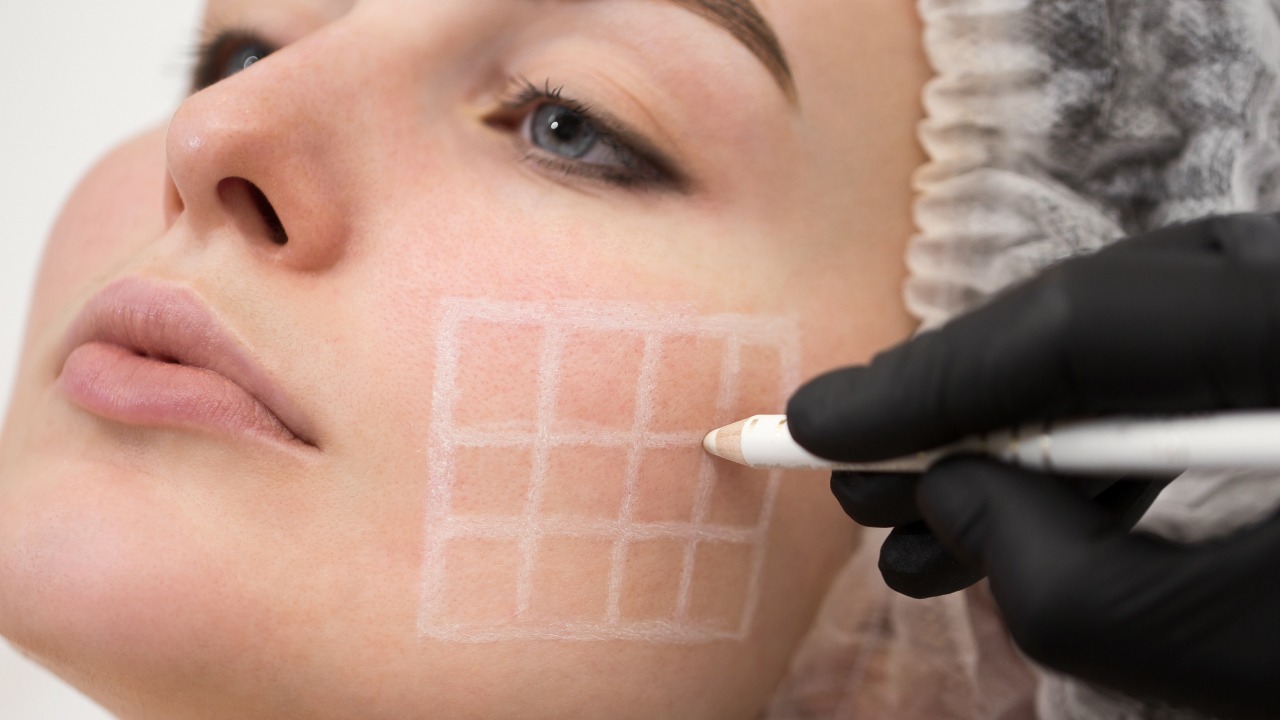 Chirurg planujący lifting twarzy na policzku pacjentki